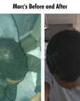 The Hair Growth Essential