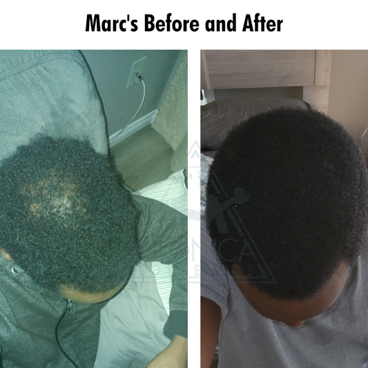 The Hair Growth Essential